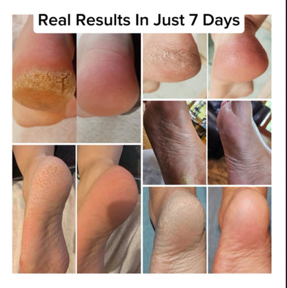 All Day Barrier - Tallow-Based Cracked Heel Repair Cream